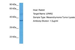 LPAR2/LPA2/EDG-4 Antibody, Novus Biologicals 100 &mu;L; Unconjugated:Antibodies,